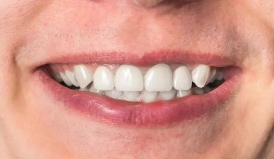 Case 1 After