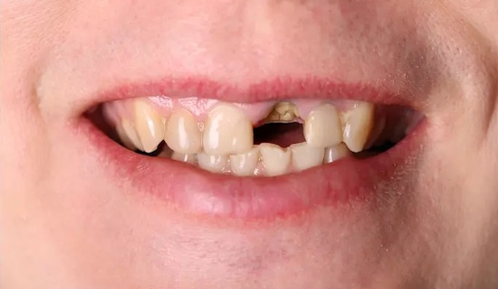 Case 1 Before